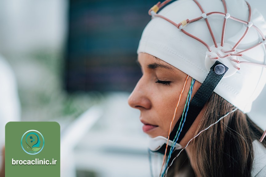 خدمات کلینیک بروکا در این حوزه