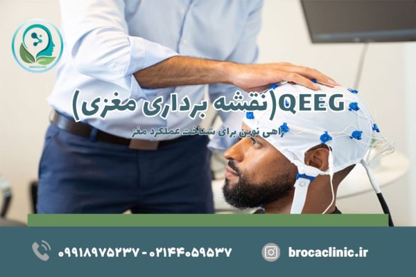 QEEG(نقشه مغزی)