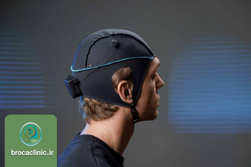 اضطراب فراگیر